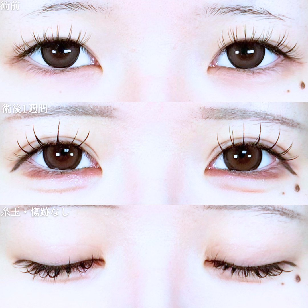 No.20865の症例写真