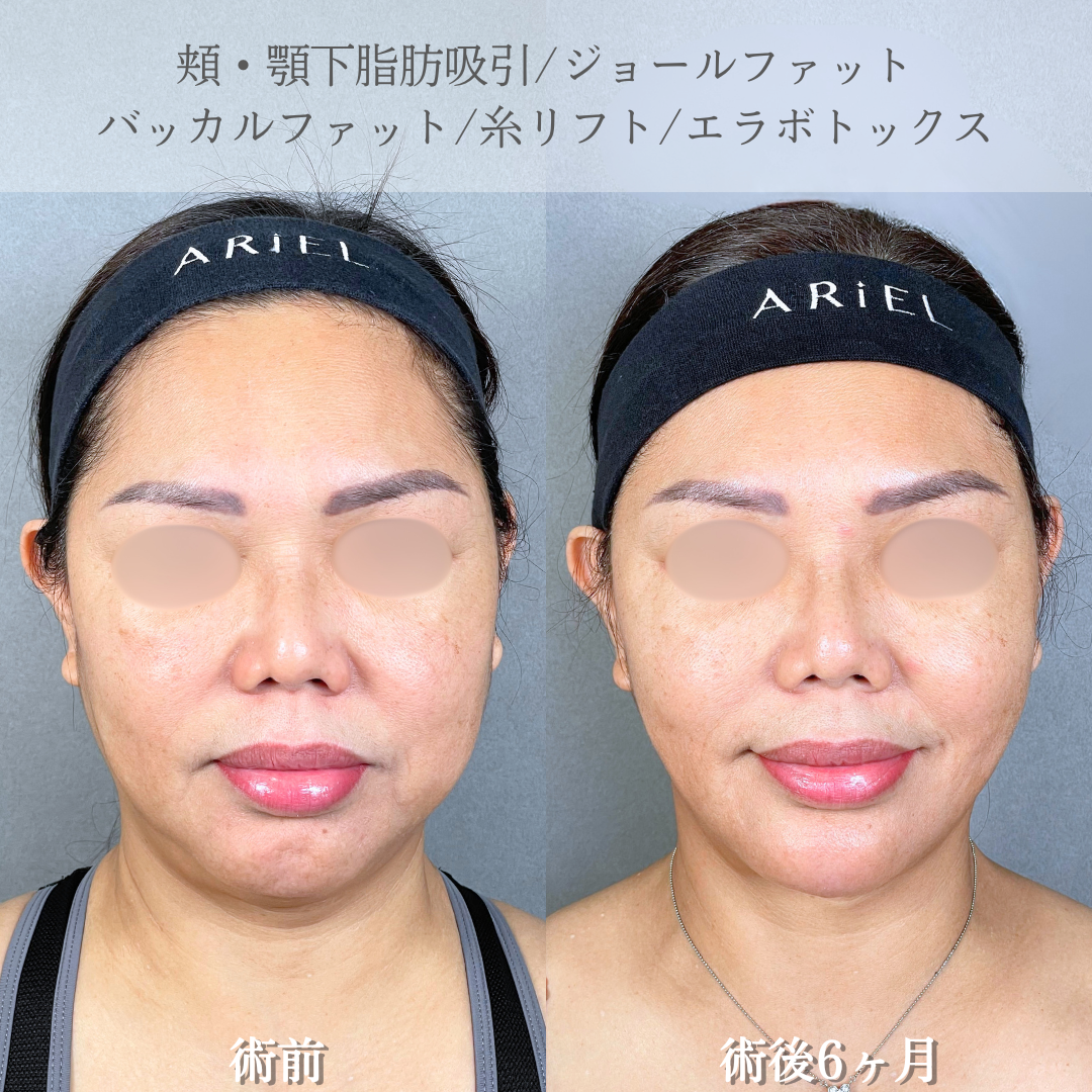 No.20876の症例写真2