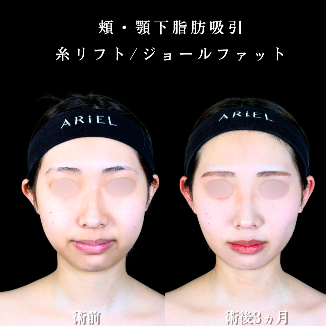 No.20894の症例写真2