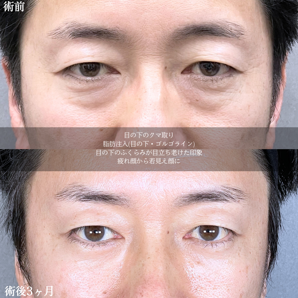 No.20916の症例写真2