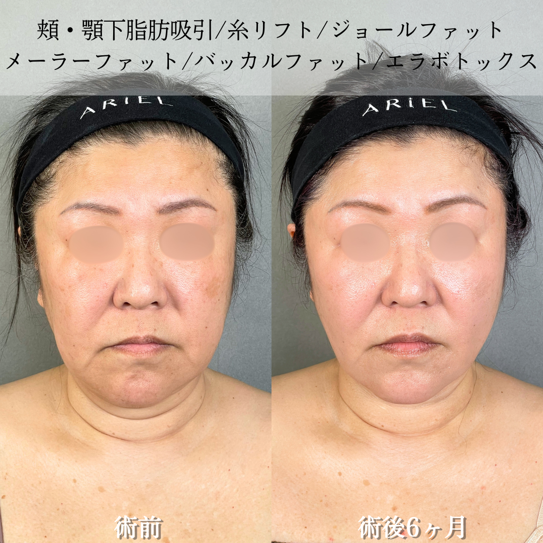 No.20679の症例写真2