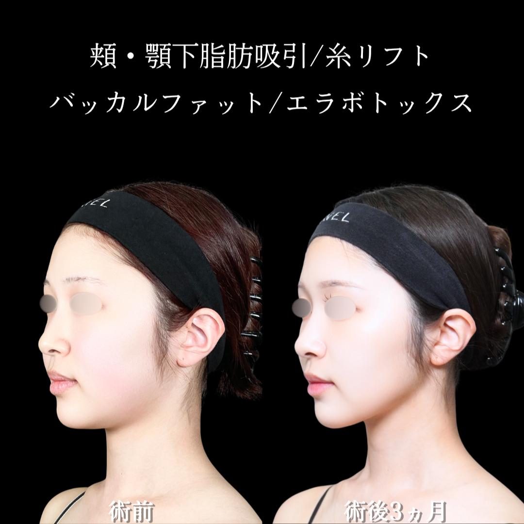 No.21006の症例写真1