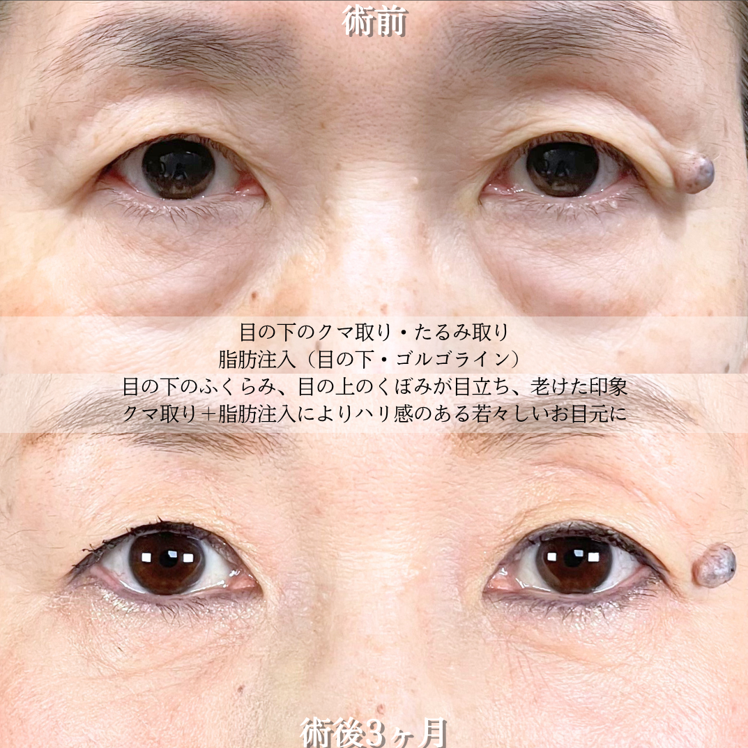 No.21027の症例写真2