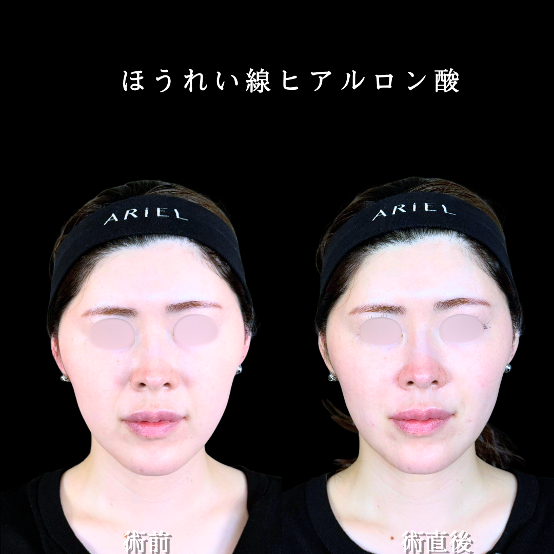 No.21034の症例写真2