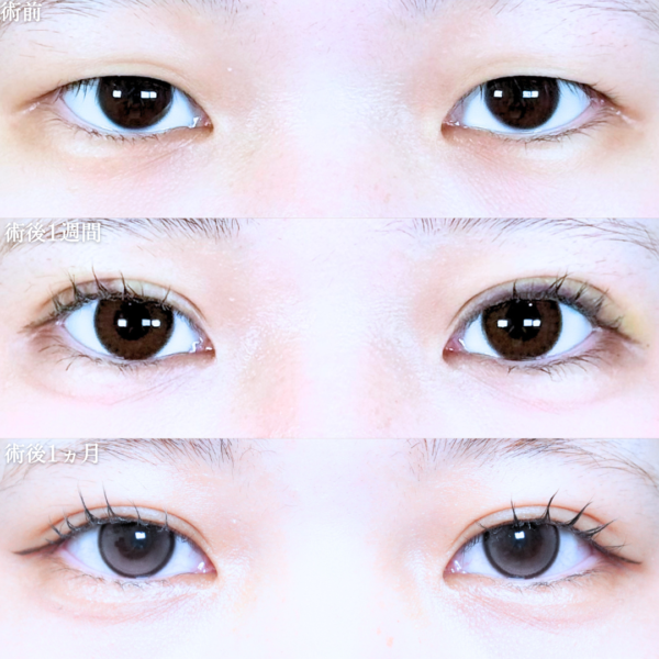 No.21066の症例写真