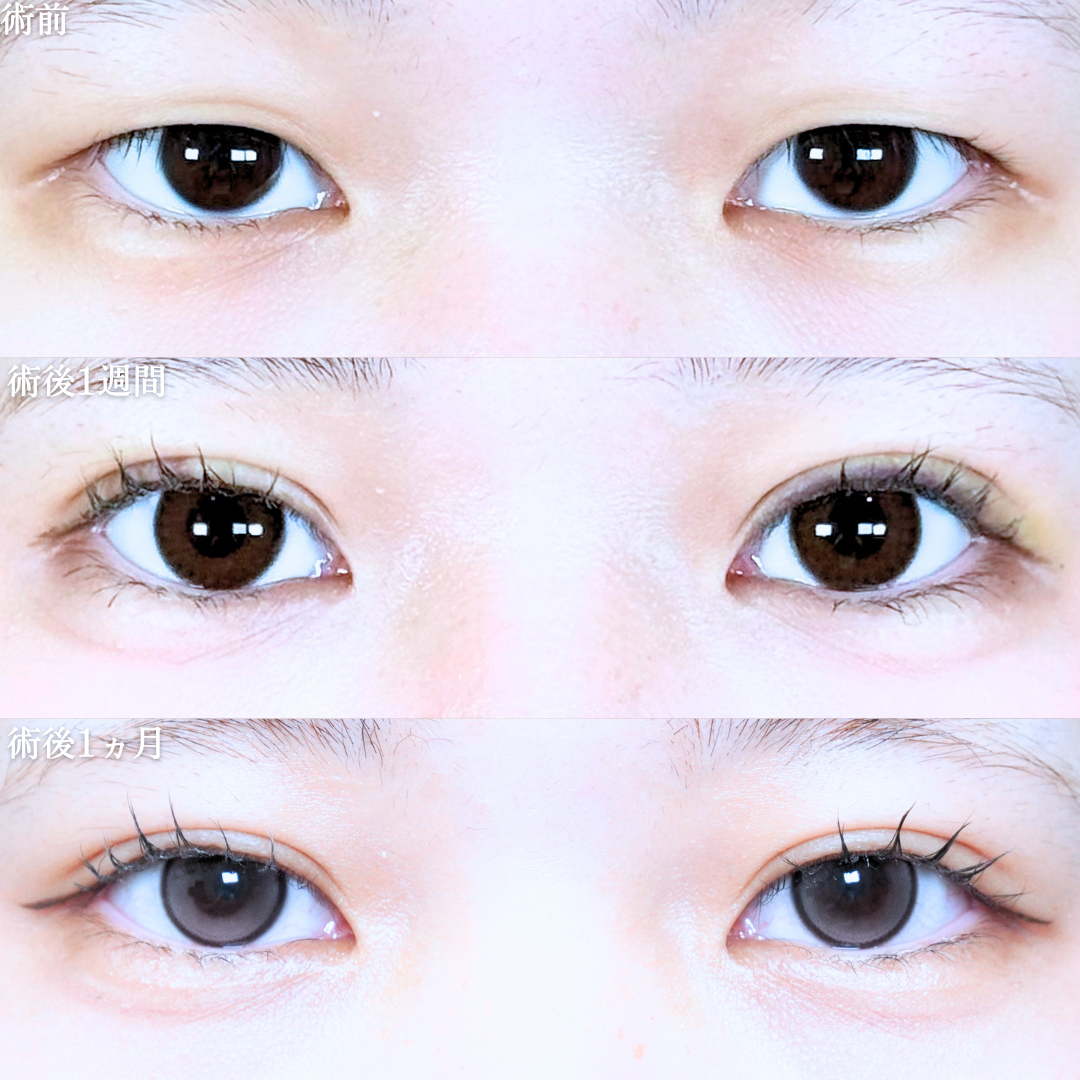 No.21066の症例写真