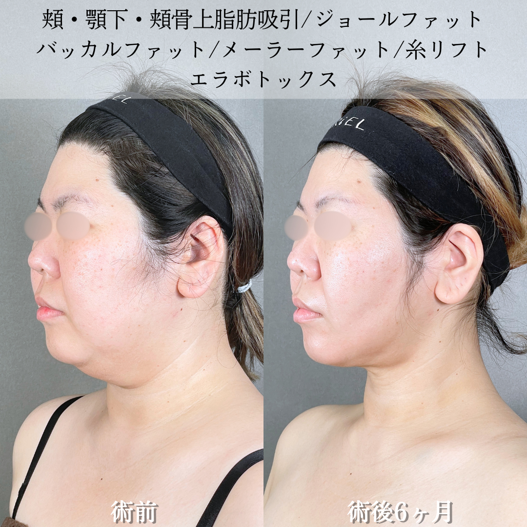 No.21082の症例写真2