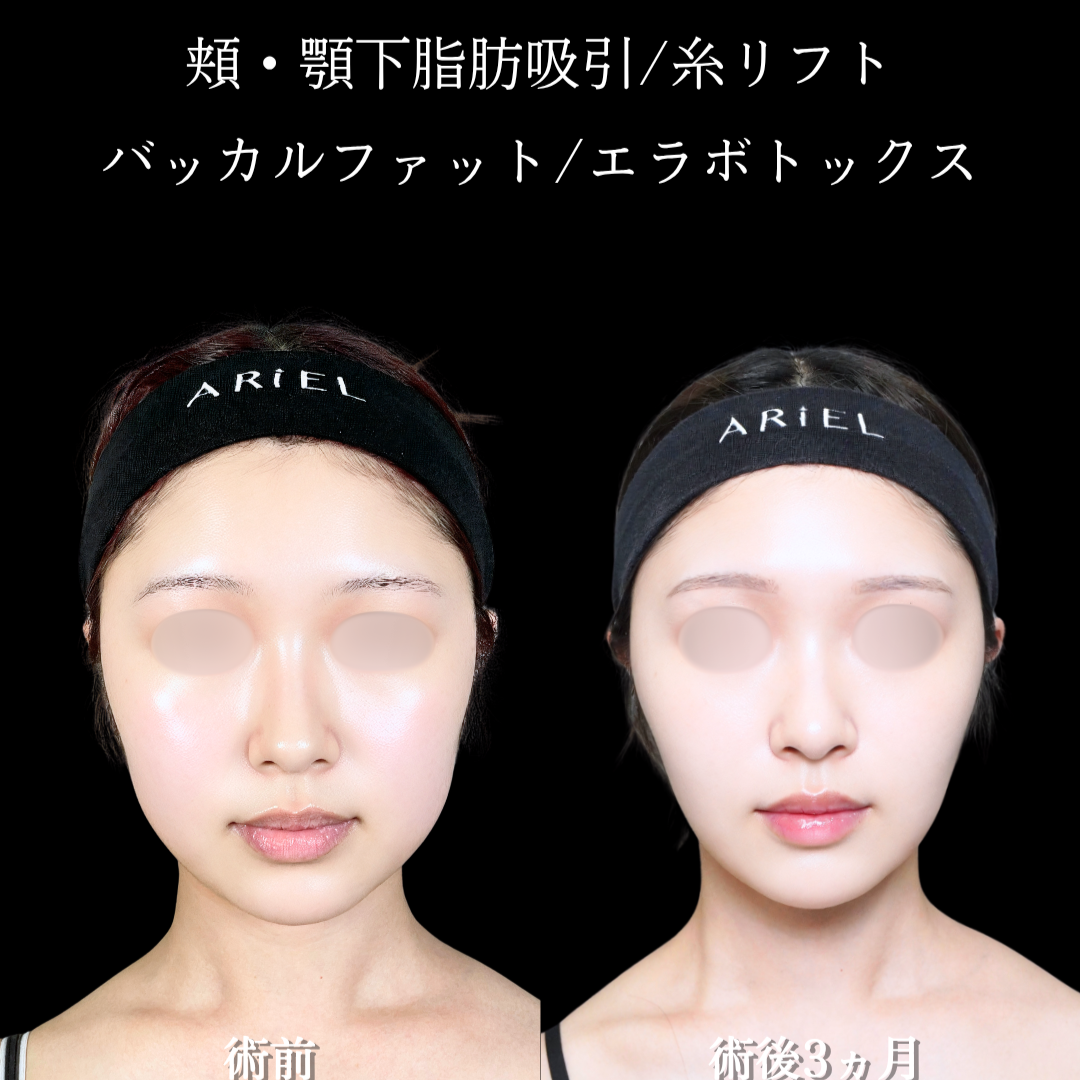 No.21090の症例写真2