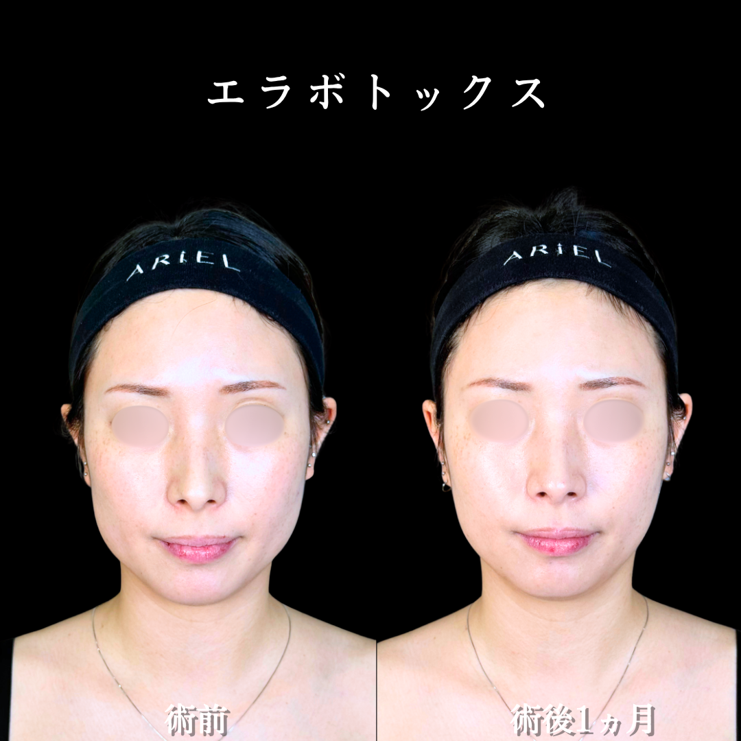 No.21089の症例写真2