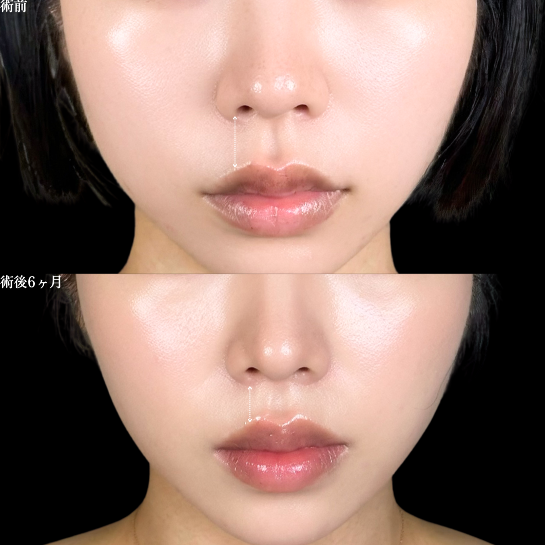 No.21110の症例写真2