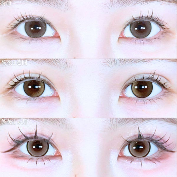 No.20694の症例写真