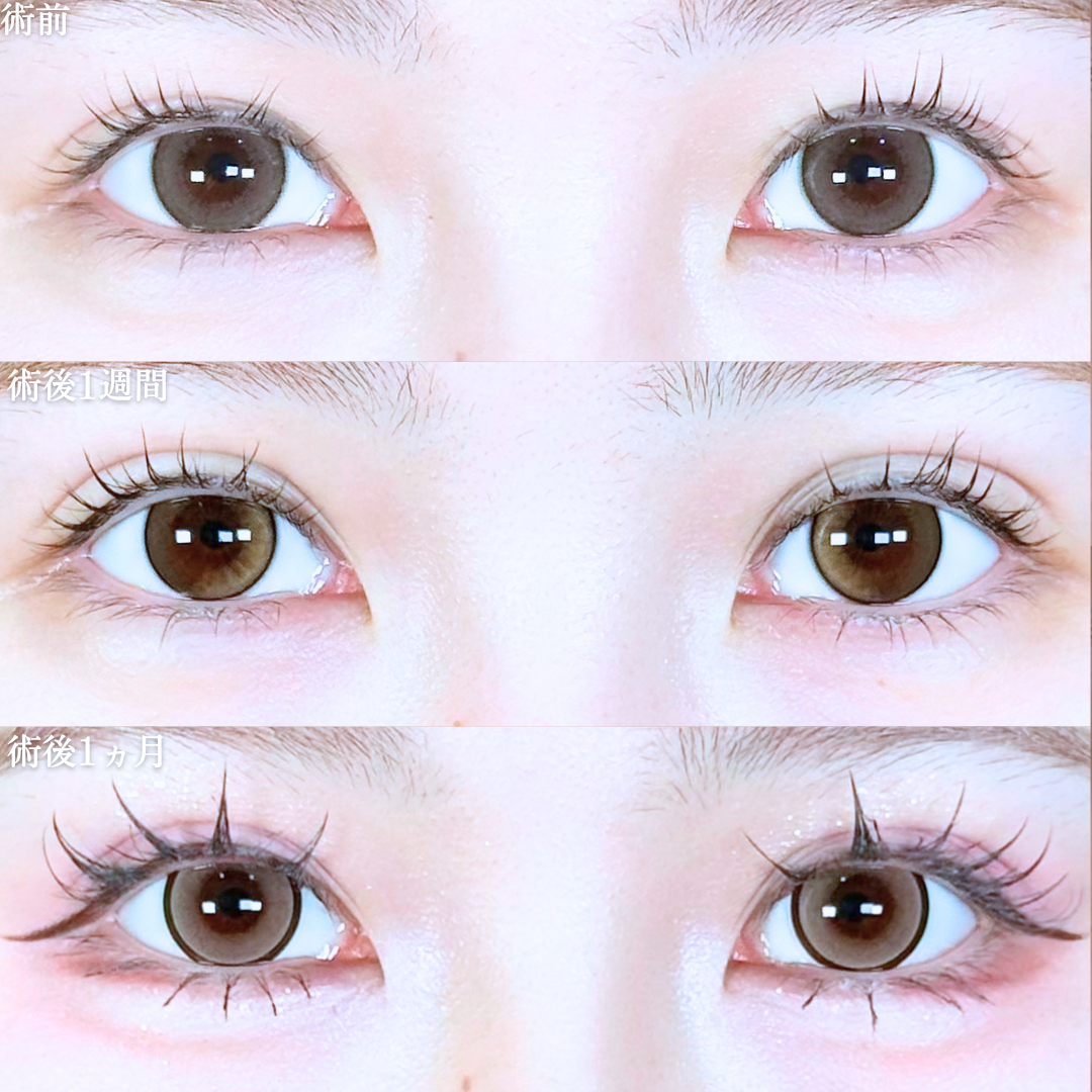 No.20694の症例写真