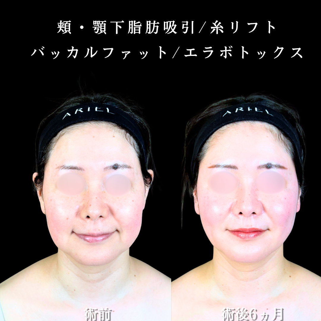 No.20726の症例写真2