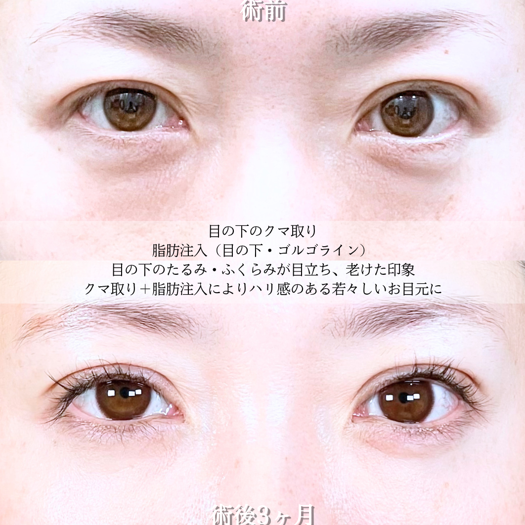 No.20733の症例写真2