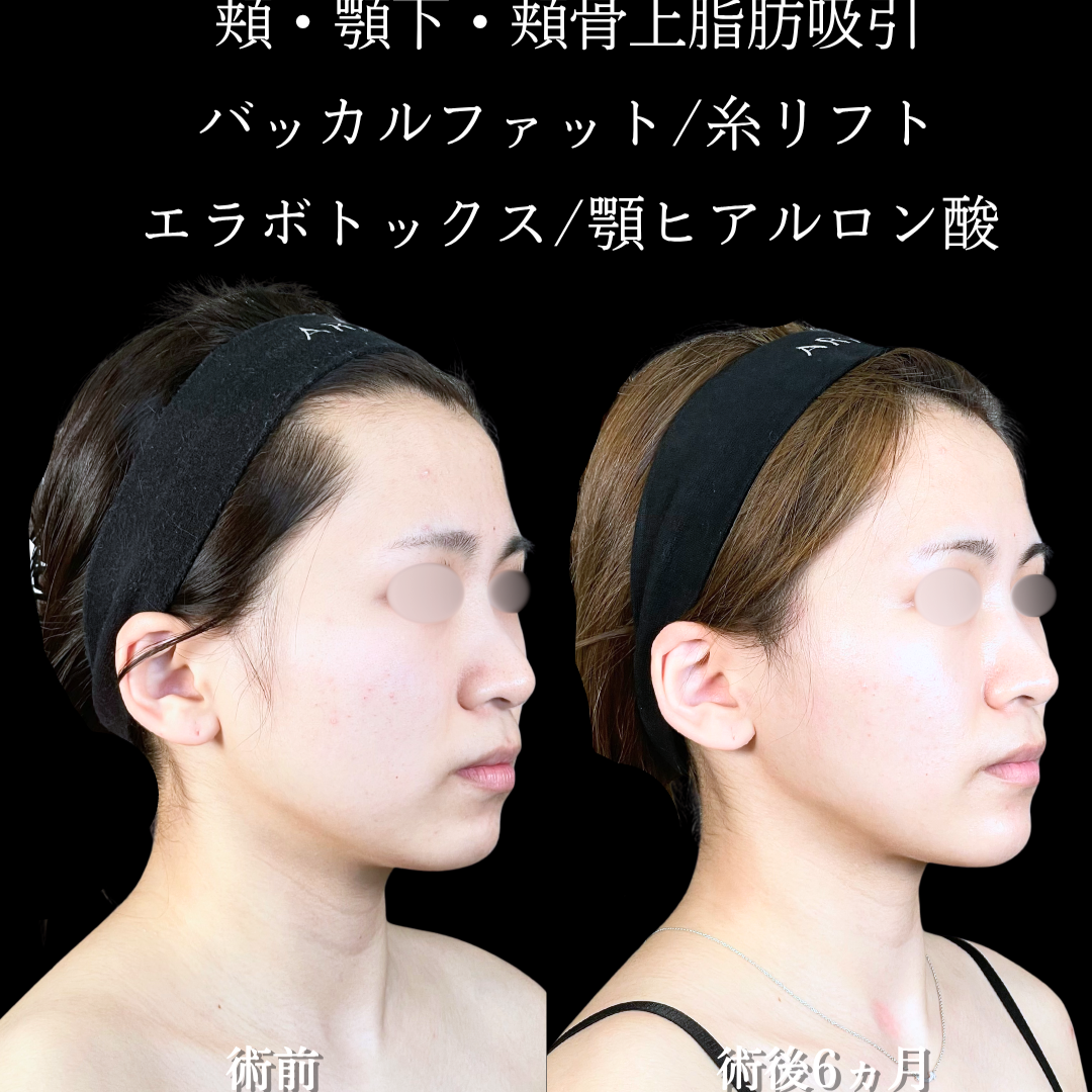 No.20742の症例写真2