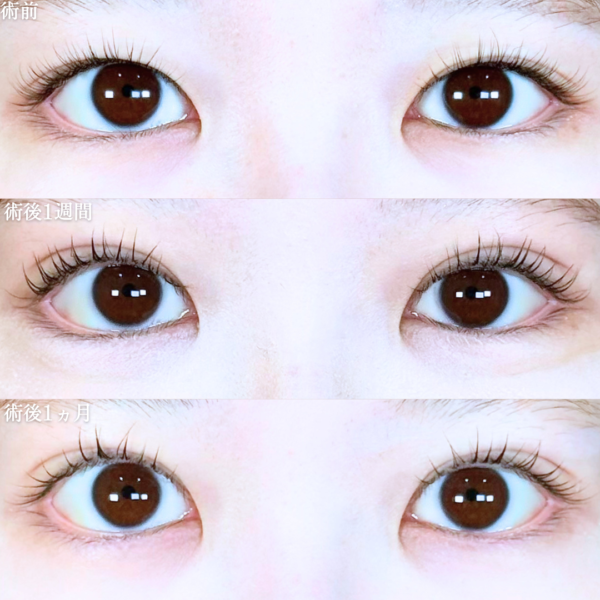 No.20751の症例写真