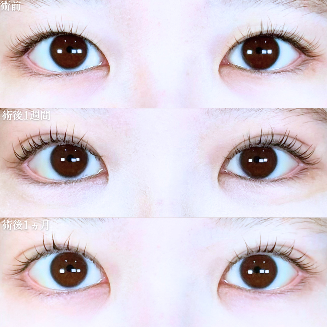 No.20751の症例写真