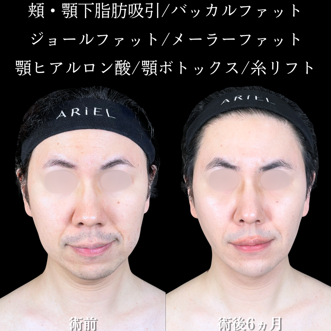 No.20775の症例写真2