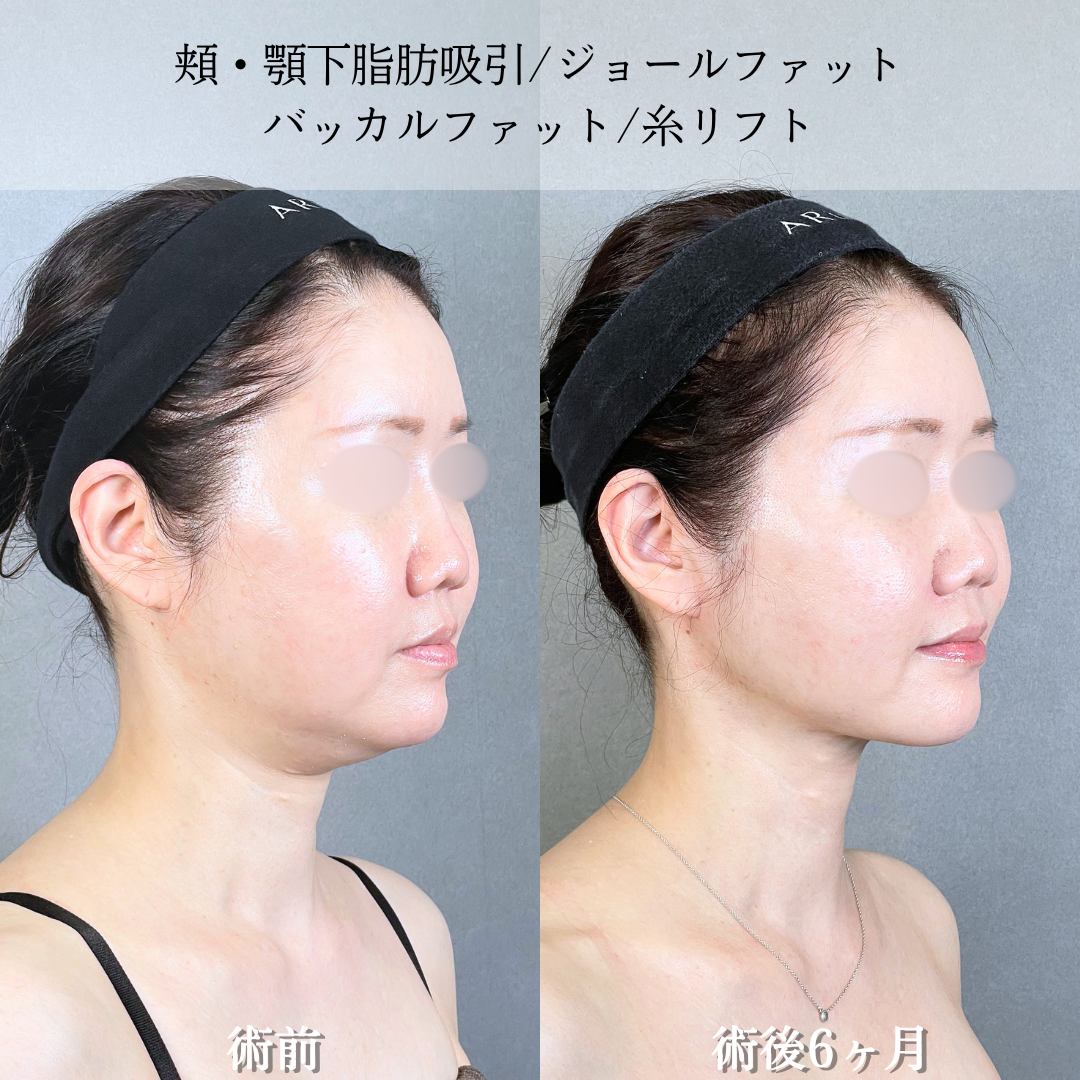 No.20783の症例写真2