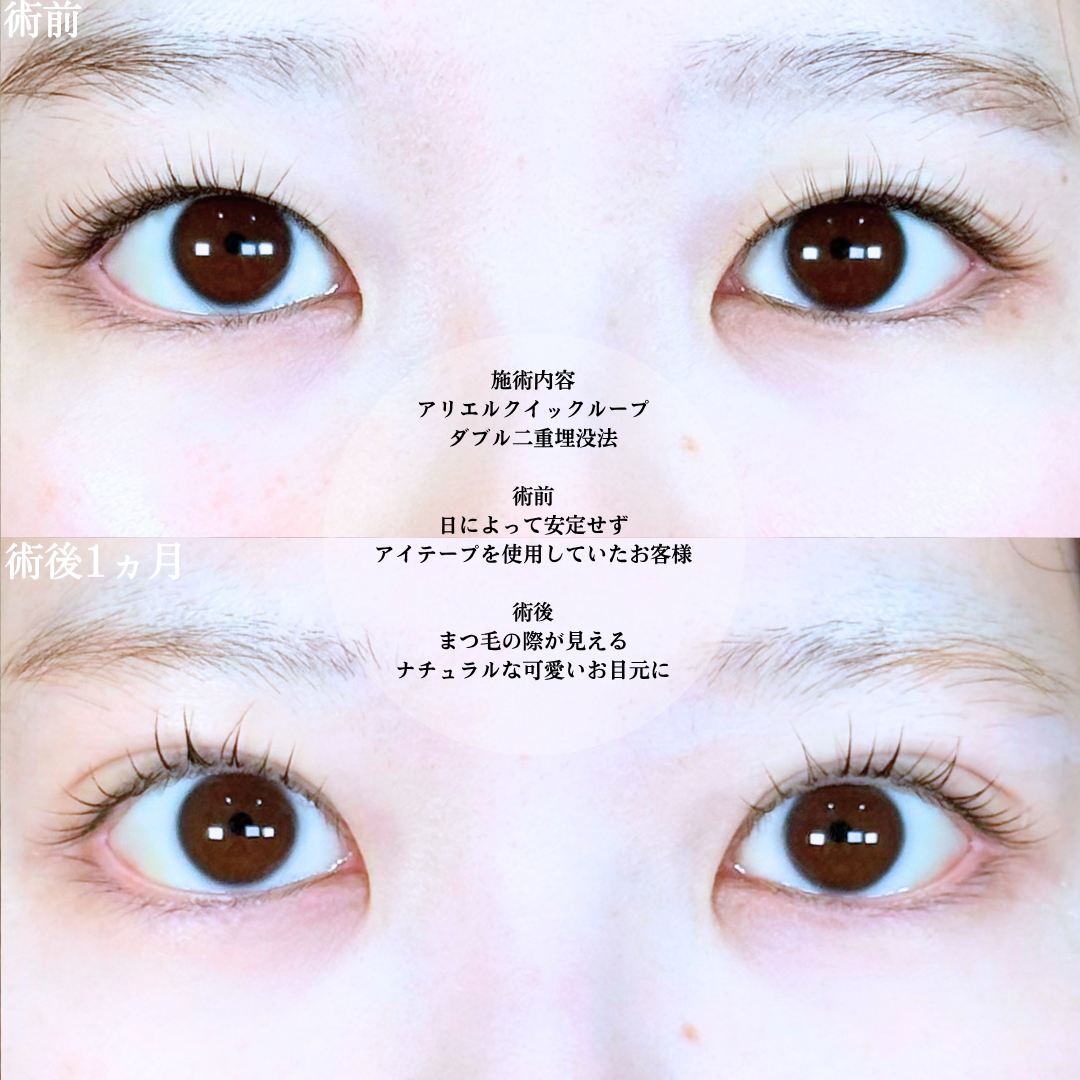 No.20751の症例写真1