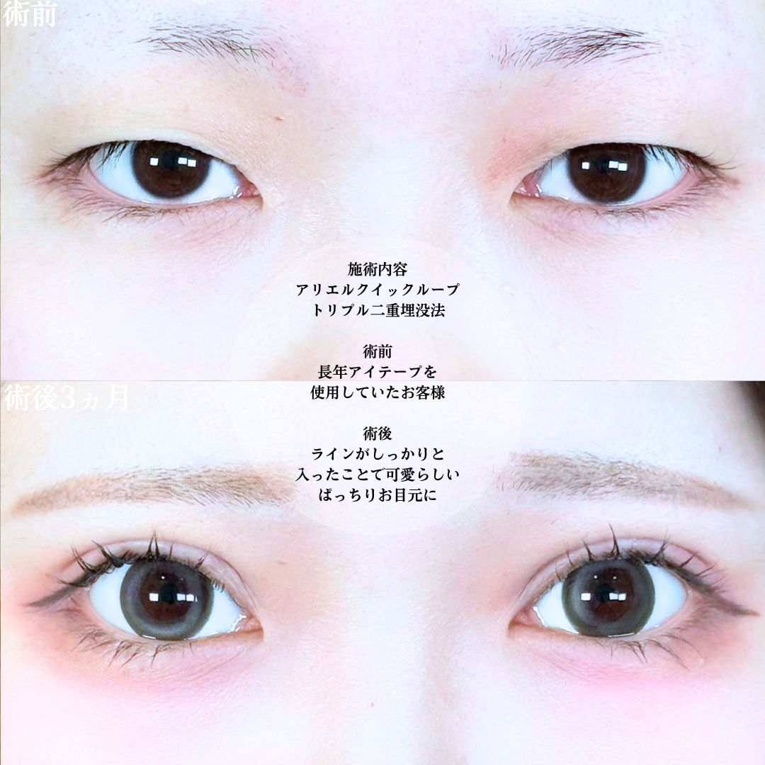 No.20812の症例写真1