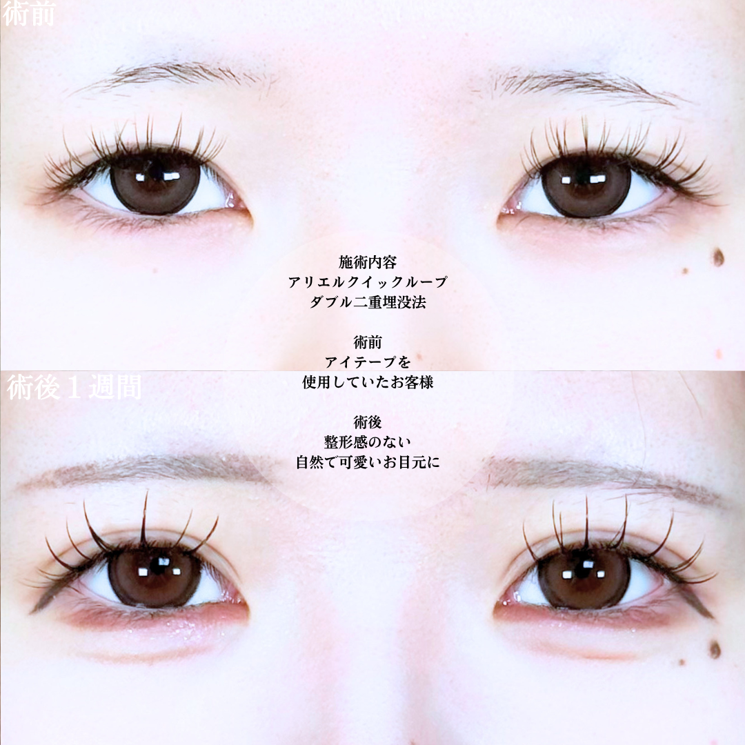 No.20865の症例写真1