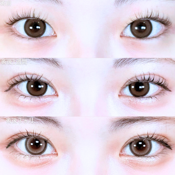 No.20905の症例写真