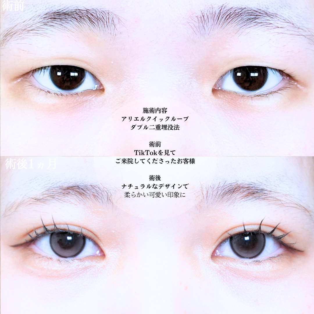 No.21066の症例写真1