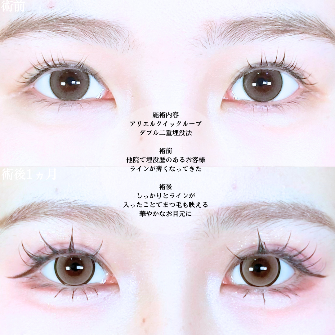 No.20694の症例写真1