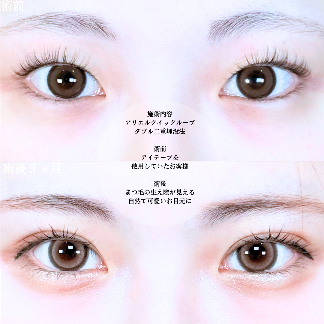 No.20905の症例写真1