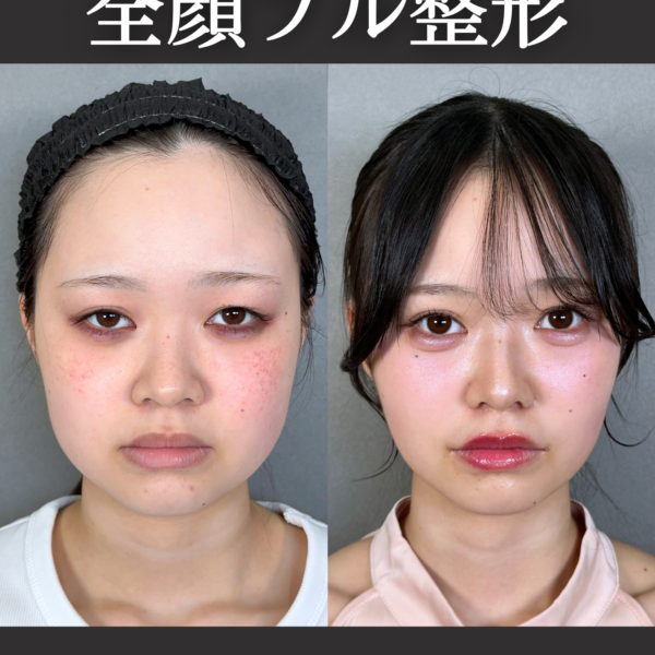 No.21057の症例写真