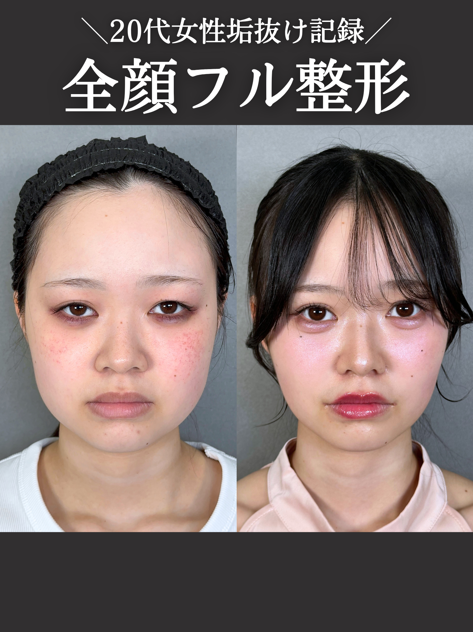 No.21057の症例写真