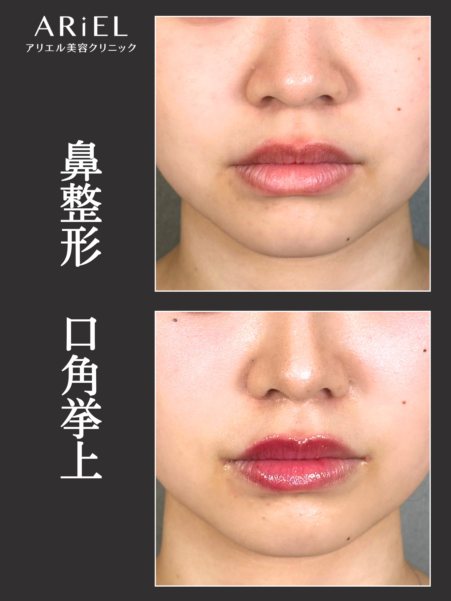 No.21057の症例写真1