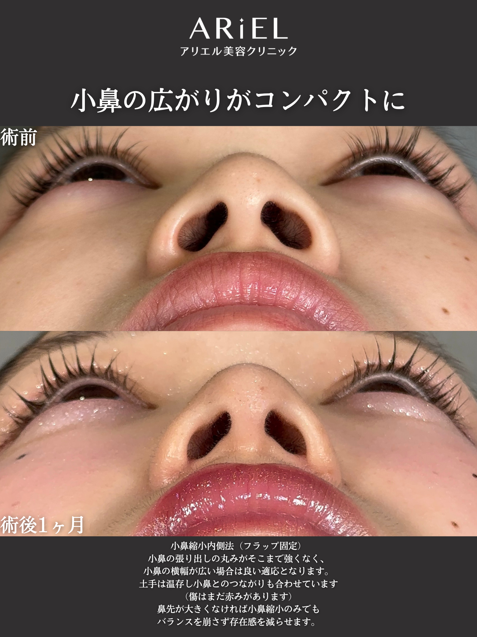 No.21057の症例写真2