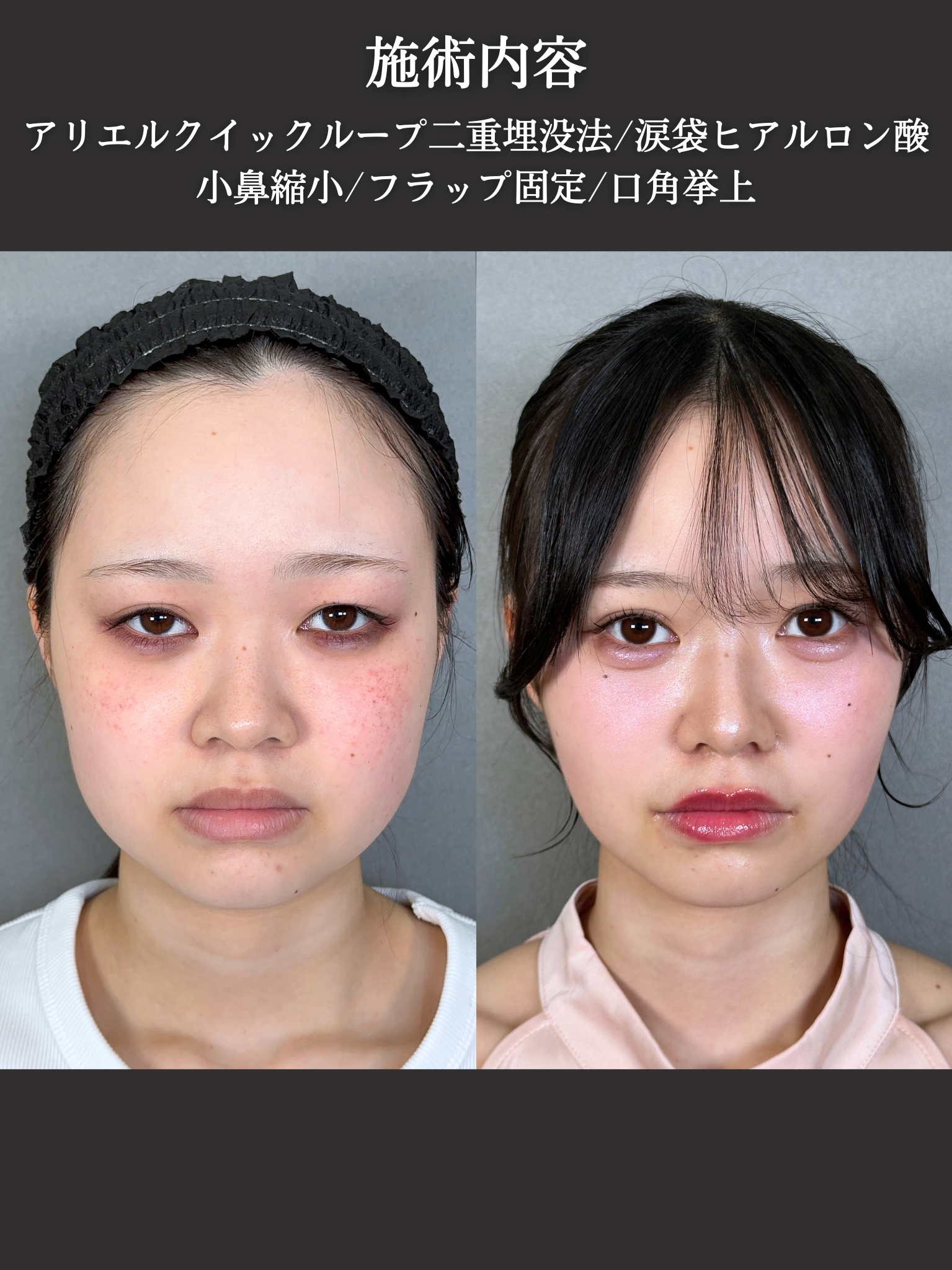 No.21057の症例写真3