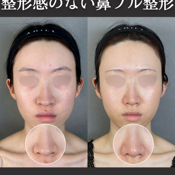 No.21013の症例写真