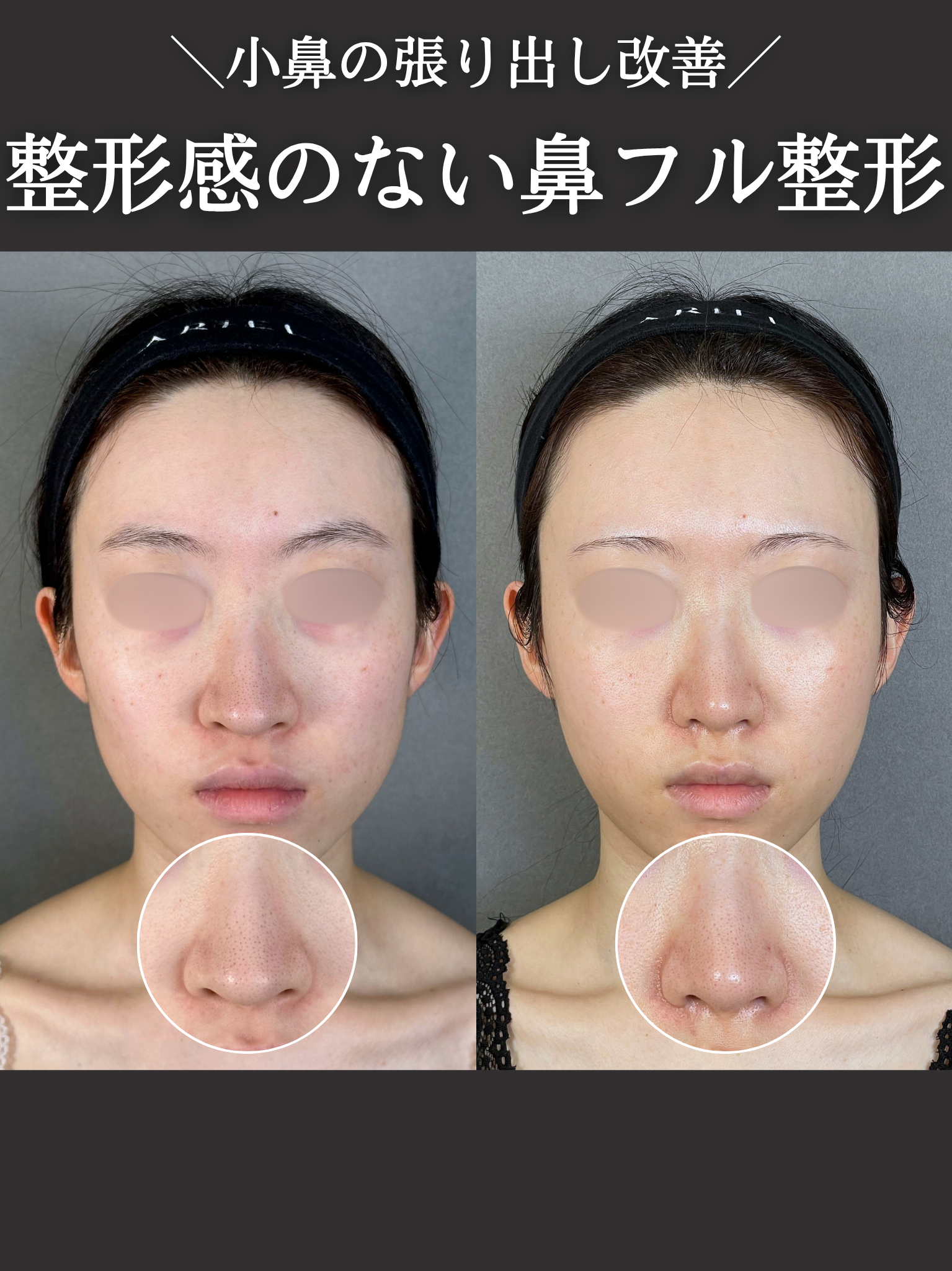 No.21013の症例写真