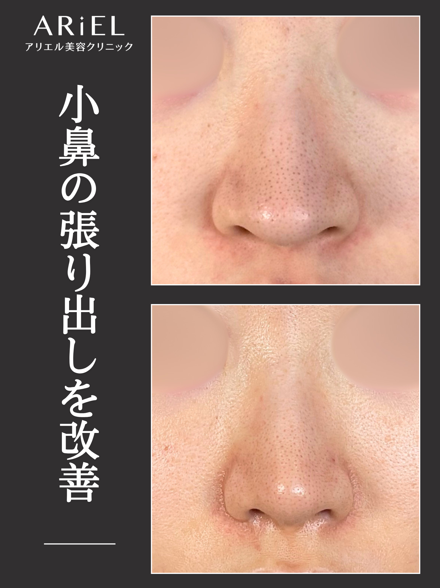 No.21013の症例写真1