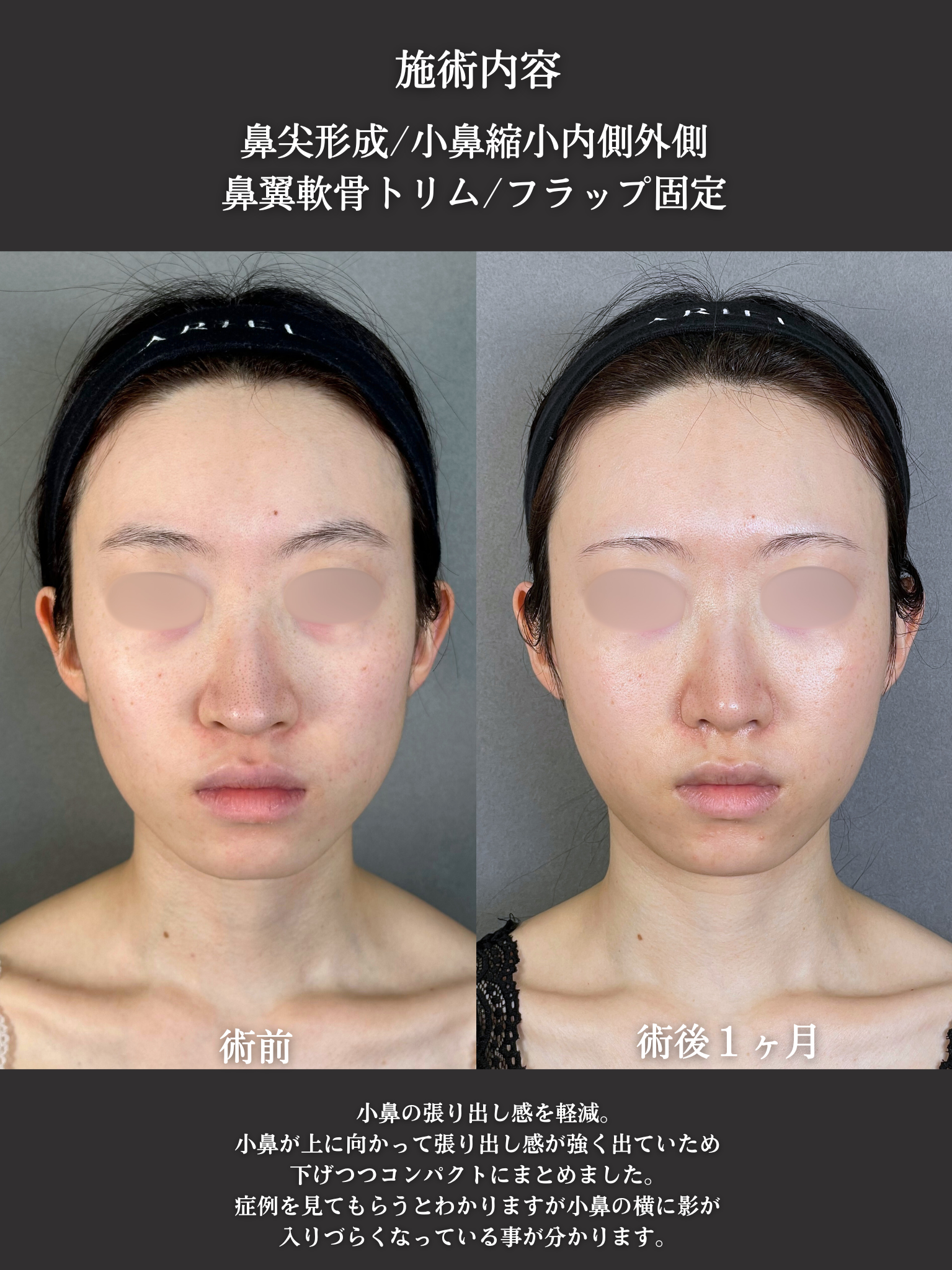 No.21013の症例写真2