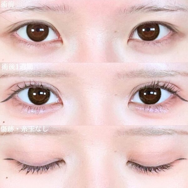 No.20800の症例写真