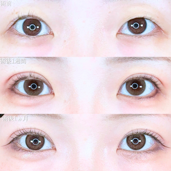 No.20641の症例写真 No.20641の症例写真