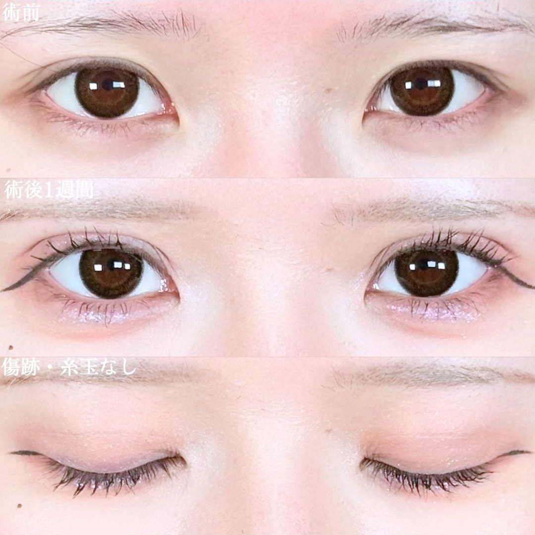 No.20800の症例写真