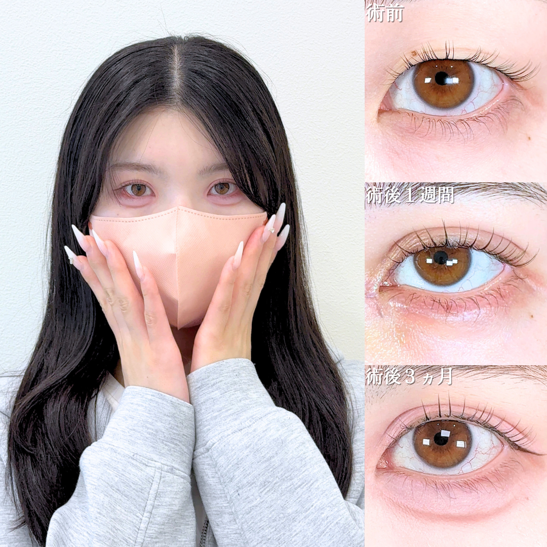 No.21119の症例写真