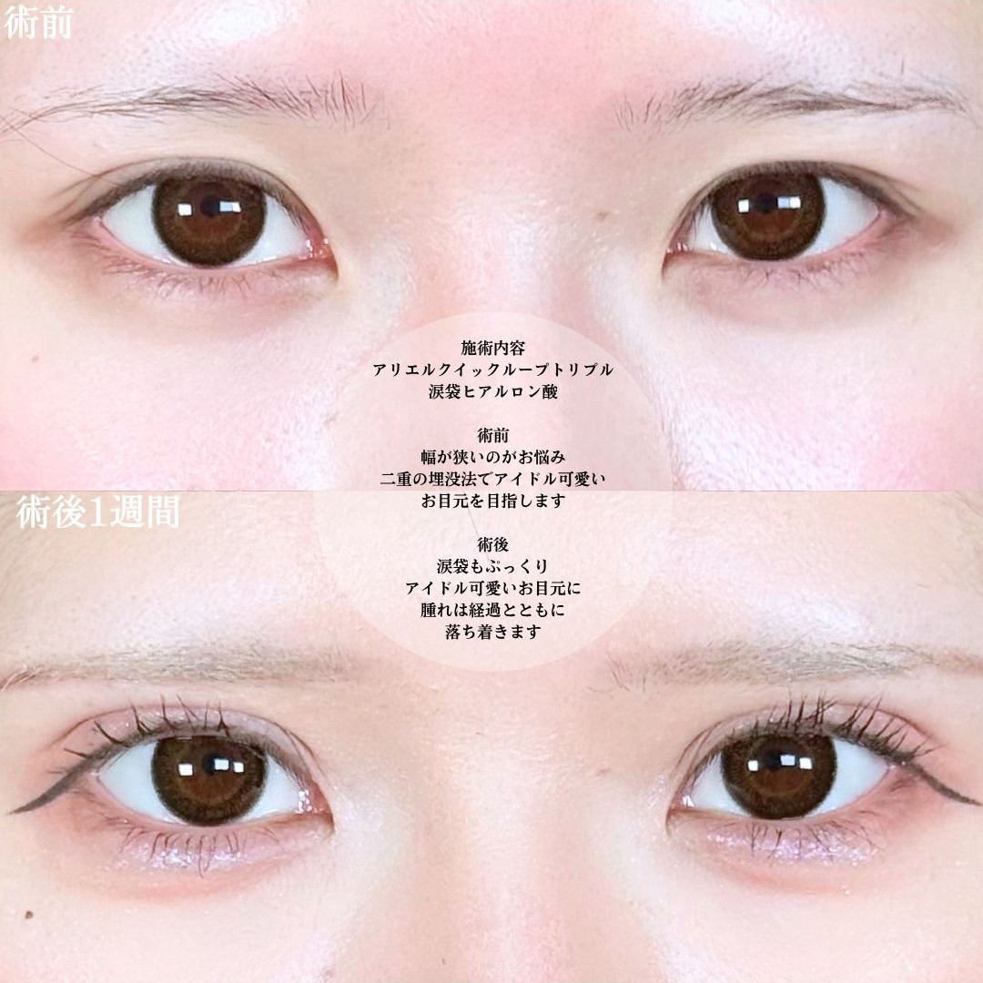 No.20800の症例写真1