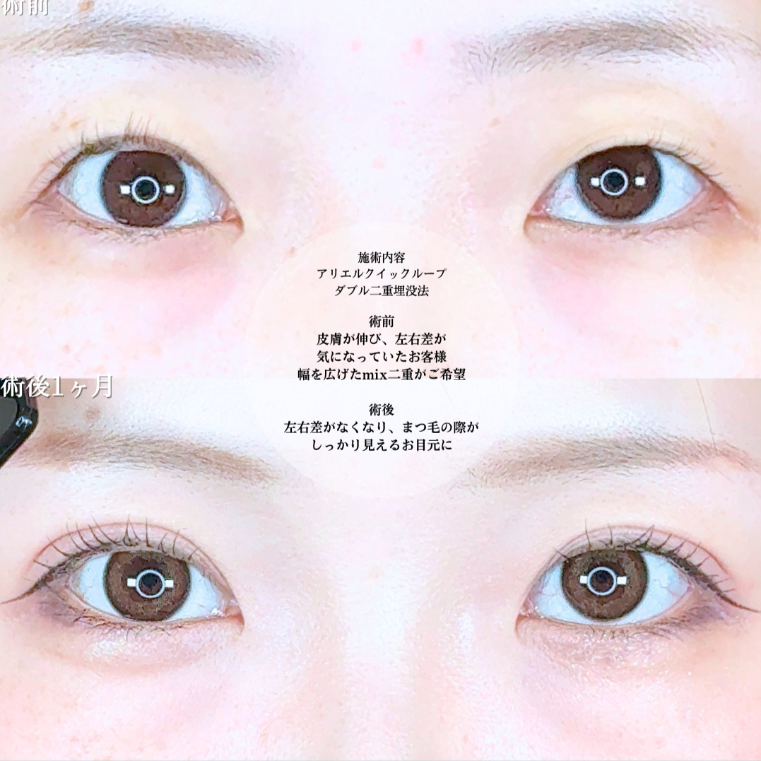 No.20641の症例写真1