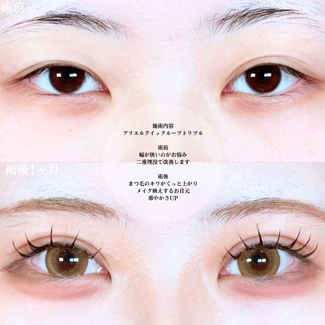 No.20848の症例写真1