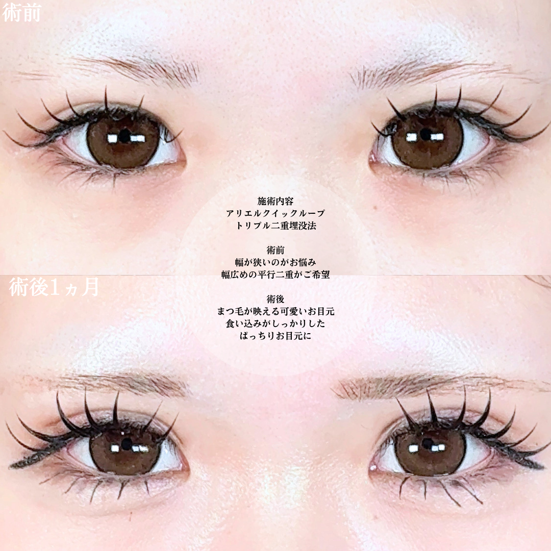 No.20654の症例写真1