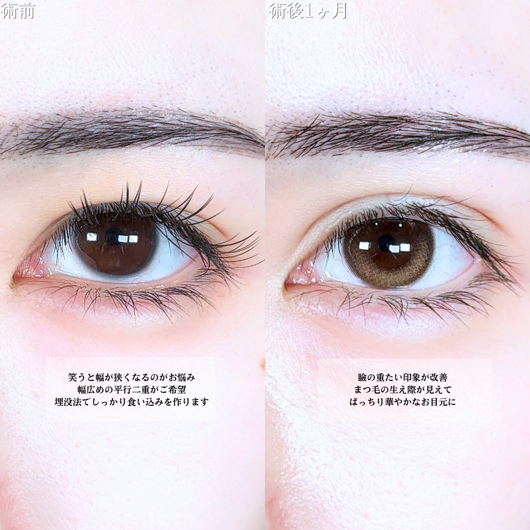 No.20686の症例写真1