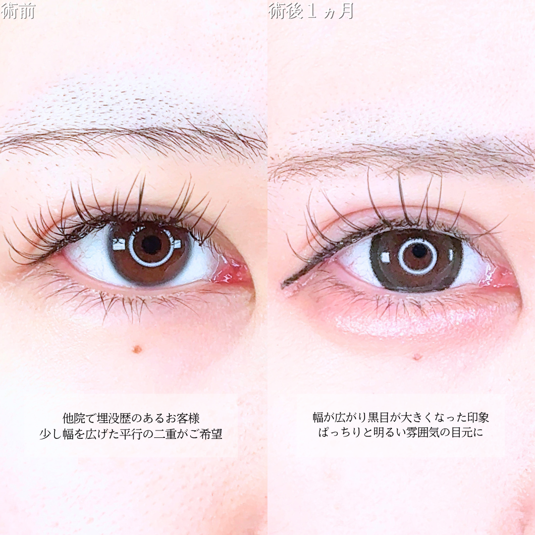 No.20692の症例写真1