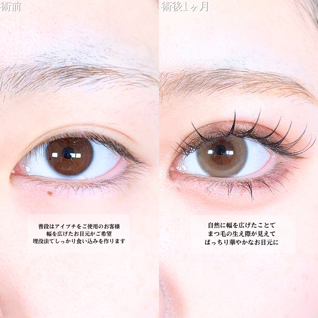 No.20749の症例写真1